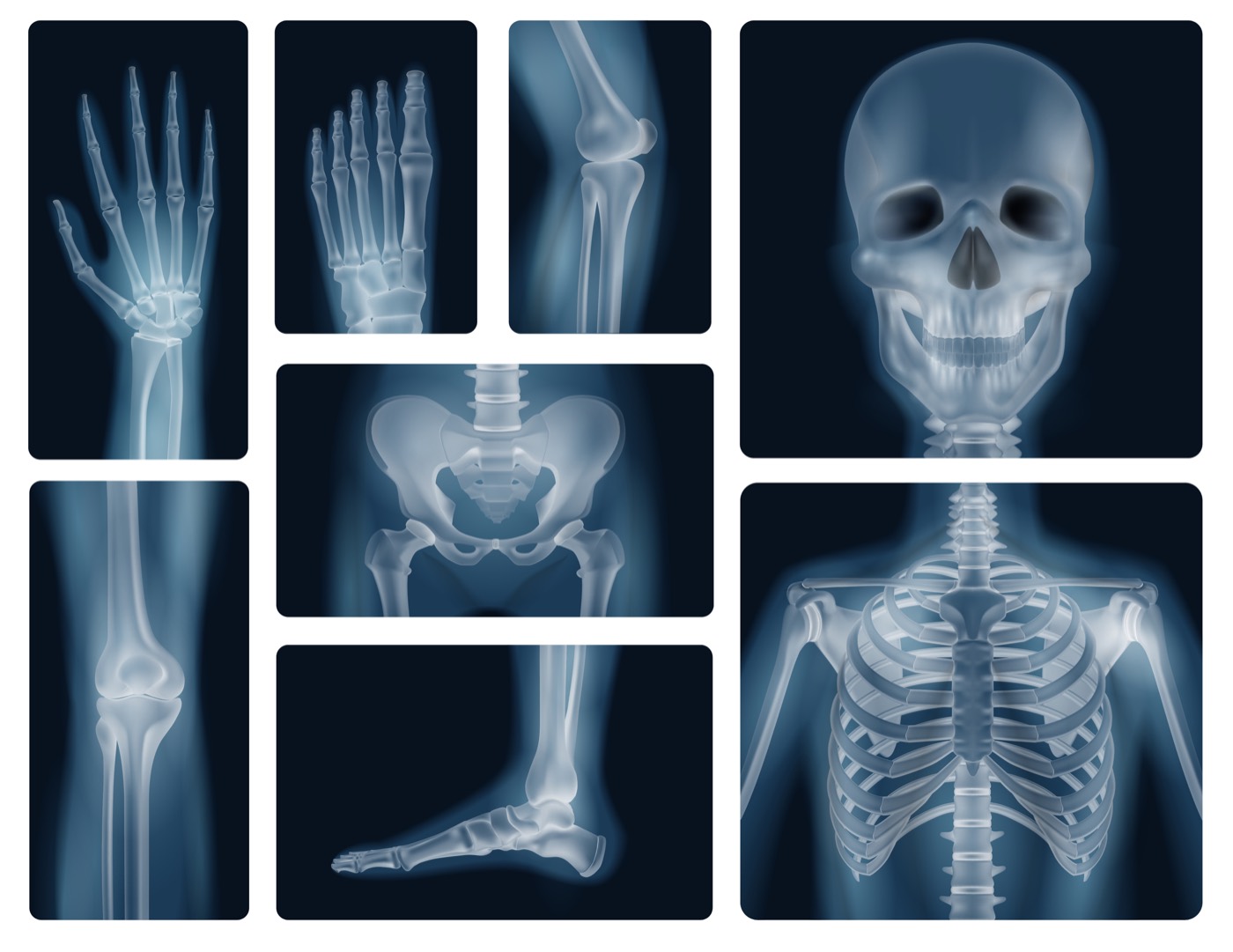 Radiography
